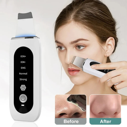 Lunaria™ UltraClean Scrubber – Deep Pore & Blackhead Remover