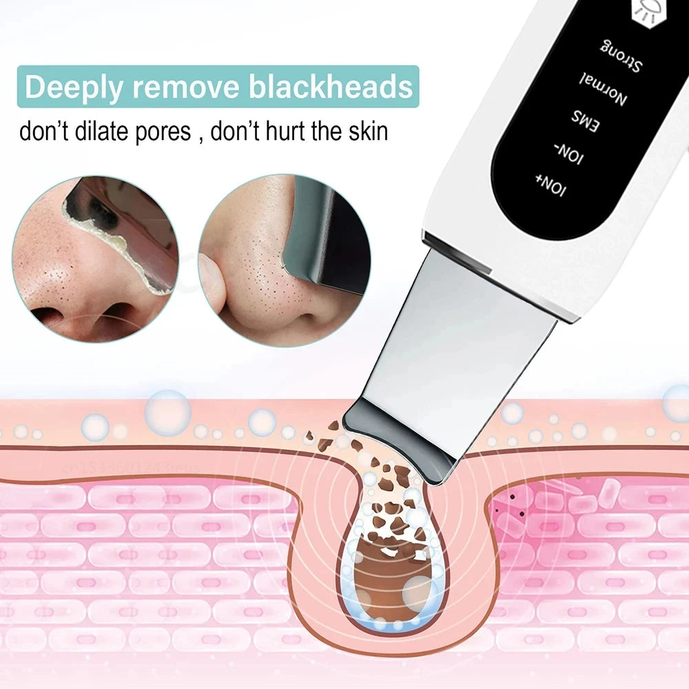Lunaria™ UltraClean Scrubber – Deep Pore & Blackhead Remover