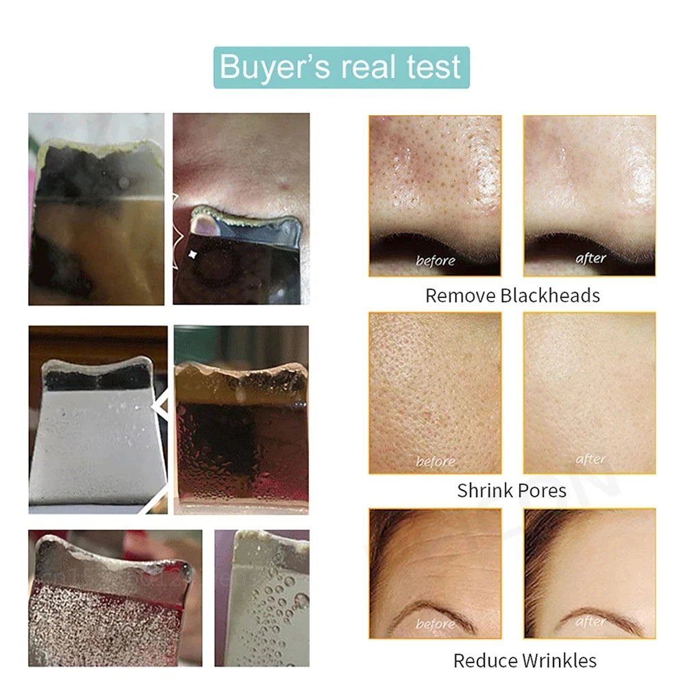 Lunaria™ UltraClean Scrubber – Deep Pore & Blackhead Remover